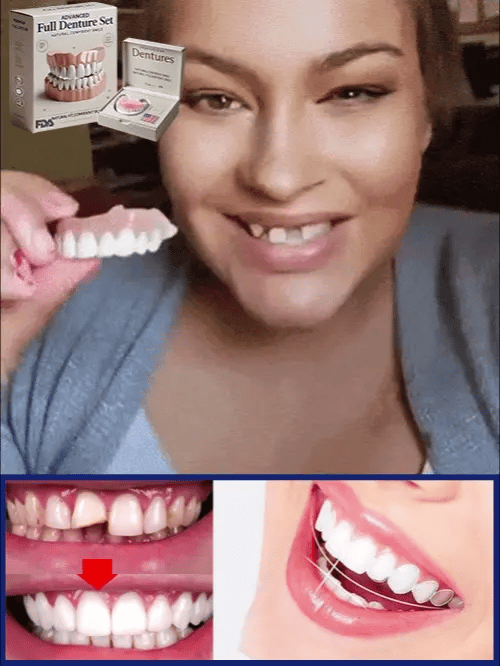 š¦·Full Denture Set