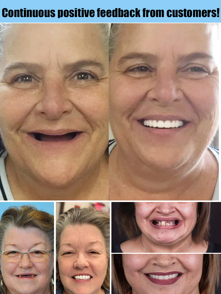 š¦·Full Denture Set